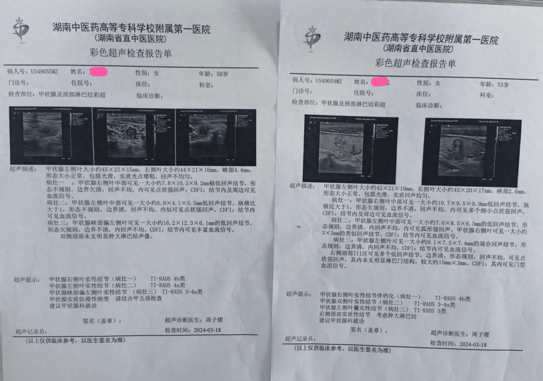 震惊！母女相继遭遇罕见癌症侵袭——甲状腺髓样癌的警示