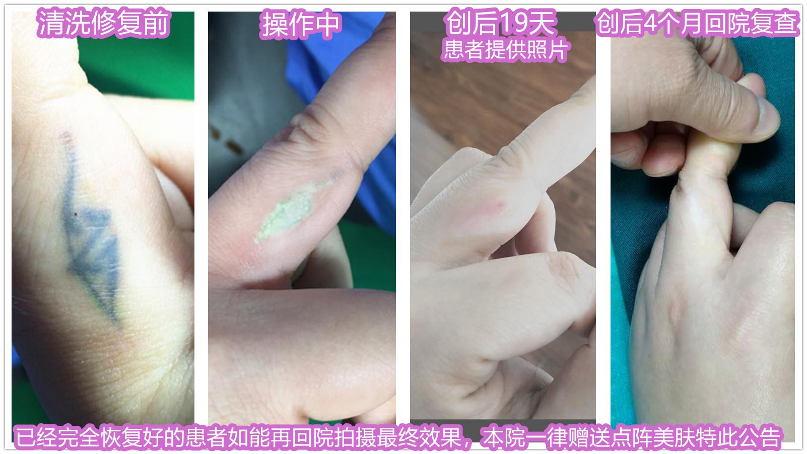 惊！14岁少女为洗文身竟花76万，父母崩溃，谁来为青春买单？